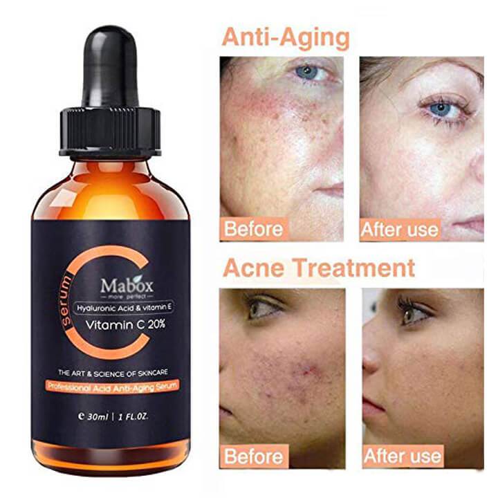 Optimal Vitamin C Serum For Face Best Selling 2019 2020