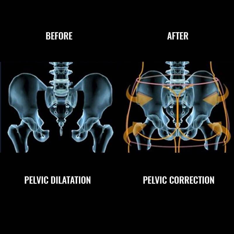 InstaLyft™ Hip-up Pelvis Correction Belt