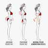 InstaLyft™ Hip-up Pelvis Correction Belt
